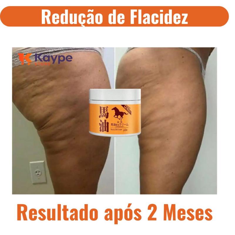 Creme Redutor de Flacidez com Ácido Hialurônico e Colágeno | KaypeStore