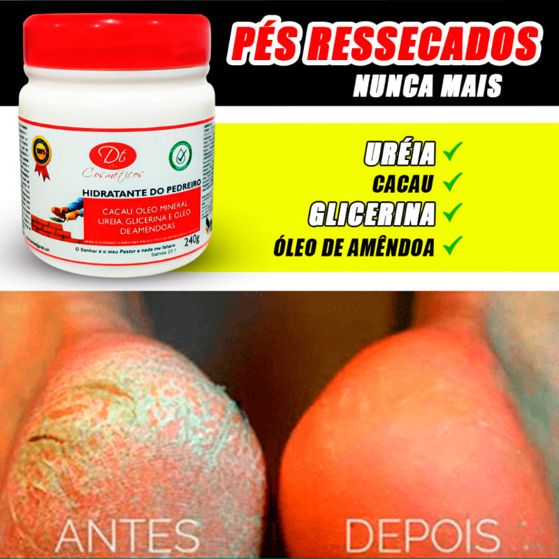 Creme Hidratante De Uréia - Para Pés Rachados E Ressecados