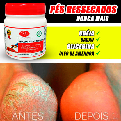 Creme Hidratante De Uréia - Para Pés Rachados E Ressecados