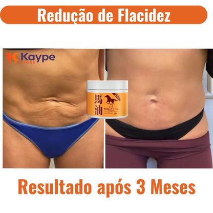 Creme Redutor de Flacidez com Ácido Hialurônico e Colágeno | KaypeStore