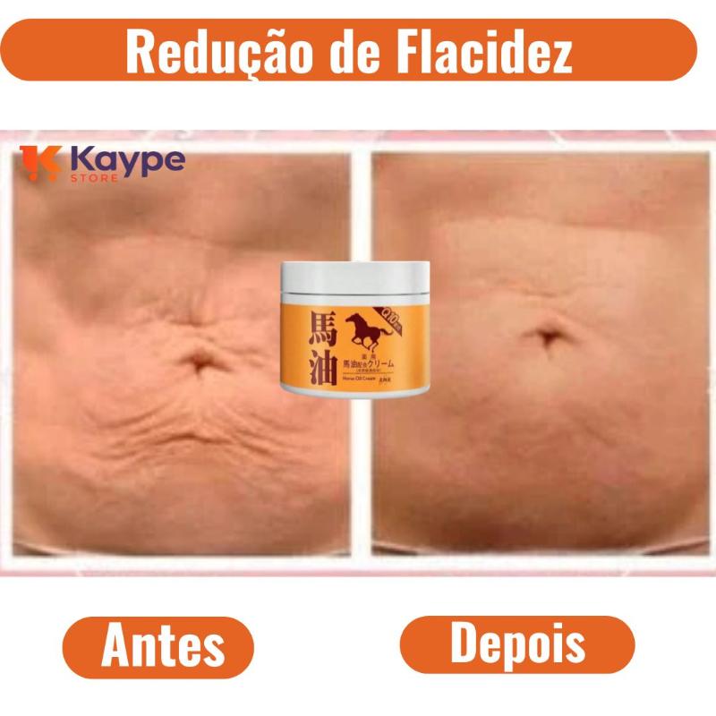 Creme Redutor de Flacidez com Ácido Hialurônico e Colágeno | KaypeStore
