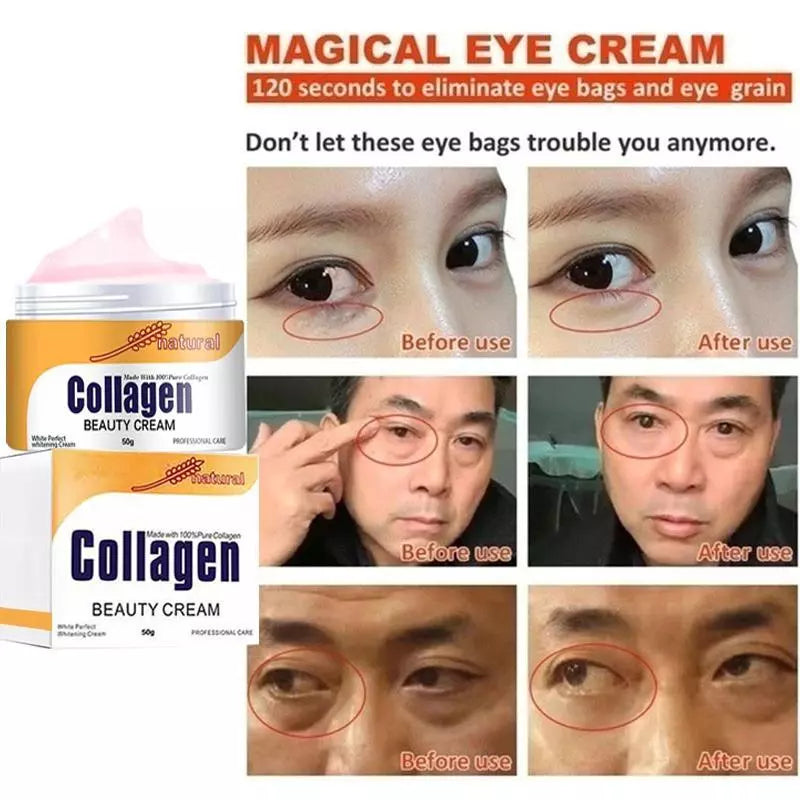 Creme de Colágeno: A Solução Definitiva para Rugas e Bolsas nos Olhos