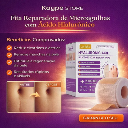 Fita Reparadora de Microagulhas com Ácido Hialurônico – Remove Cicatrizes, Estrias e Manchas
