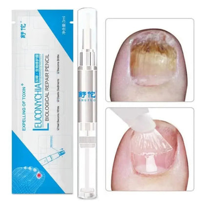 Fungo Pen – Caneta para Cuidados com as Unhas | Kaype Store