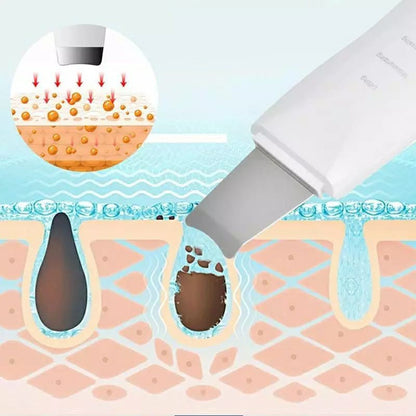 Peeling Ultrassônico Limpador Facial Anti-rugas Sonic Skin Ionização