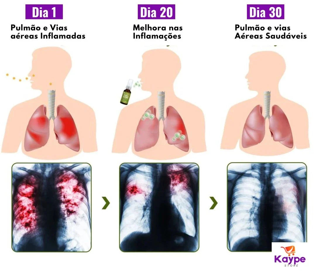 Spray HerbalTox – Frescor e Bem-Estar Respiratório Natural | Kaype Store