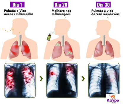 Spray HerbalTox – Frescor e Bem-Estar Respiratório Natural | Kaype Store