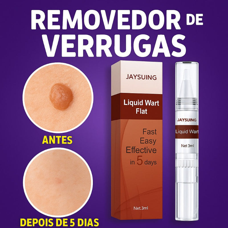 Removedor de Verrugas Genitais HPV – Tratamento Natural Masculino e Feminino