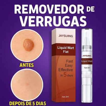 Removedor de Verrugas Genitais HPV – Tratamento Natural Masculino e Feminino