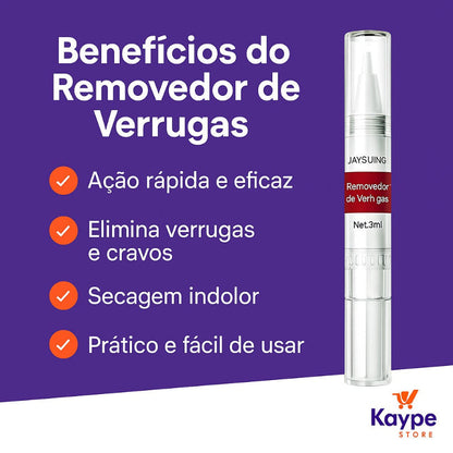 Removedor de Verrugas Genitais HPV – Tratamento Natural Masculino e Feminino