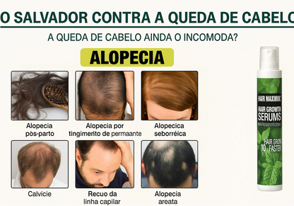 Spray para Crescimento Capilar | Combate à Queda e Fortalecimento - KaypeStore