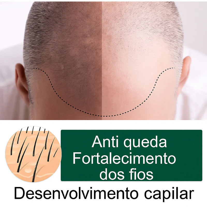 Spray para Crescimento Capilar | Combate à Queda e Fortalecimento - KaypeStore