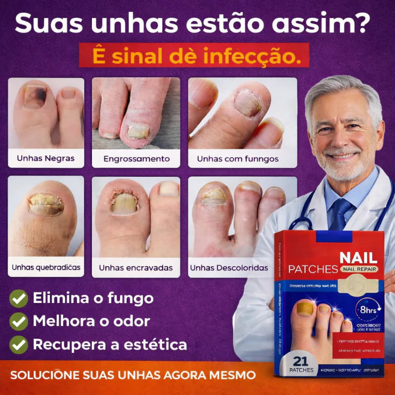 FungoFinal – Adesivo  para Unhas | Kaype Store