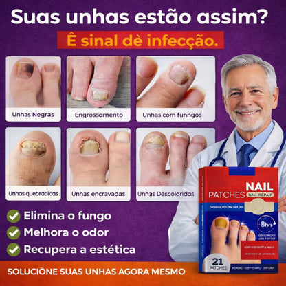 FungoFinal – Adesivo  para Unhas | Kaype Store
