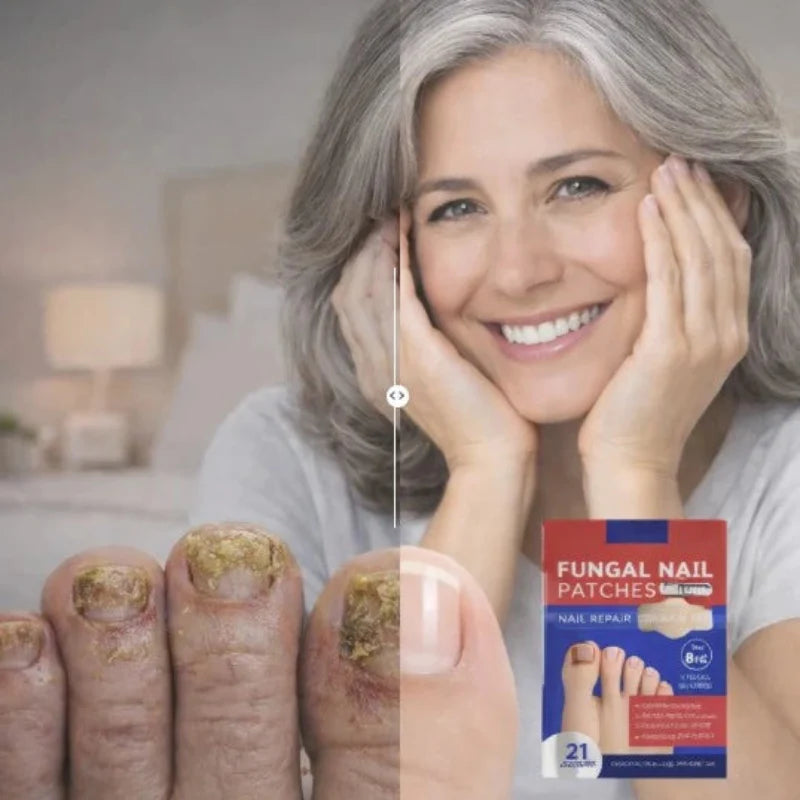 FungoFinal – Adesivo  para Unhas | Kaype Store