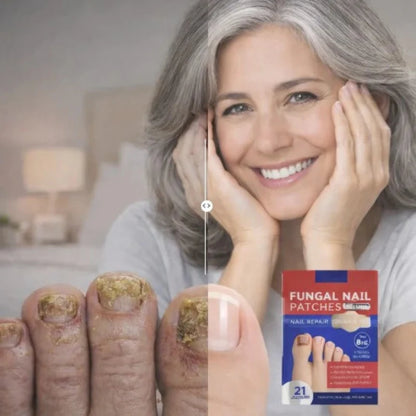 FungoFinal – Adesivo  para Unhas | Kaype Store