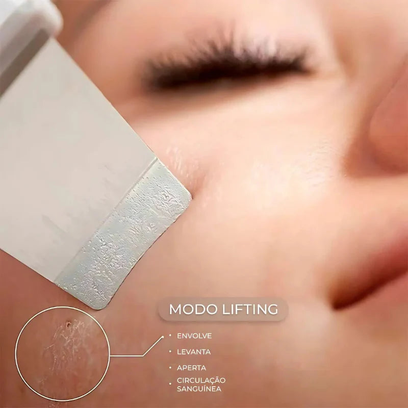 Aparelho de Peeling Ultrassônico Anti Rugas – Limpeza Facial Profunda + Remoção de Cravos