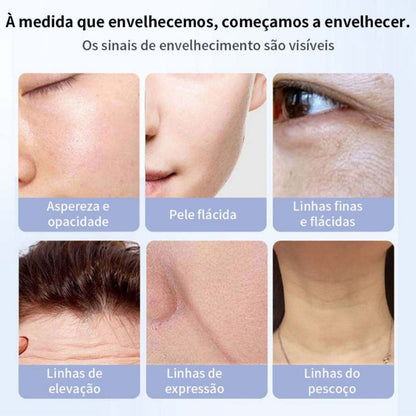 RugasRenew – Tecnologia Japonesa | Creme Anti-Rugas Rejuvenescedor & Firmador