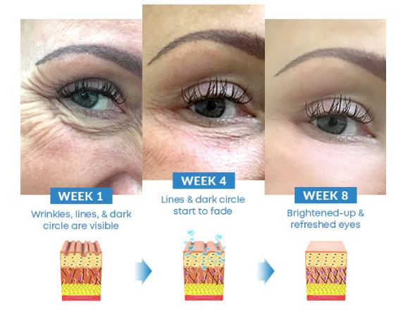Creme Clareador Anti Olheiras Bolsas Para Os Olhos
