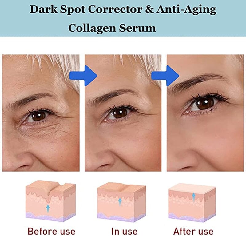 Creme Clareador Anti Olheiras Bolsas Para Os Olhos