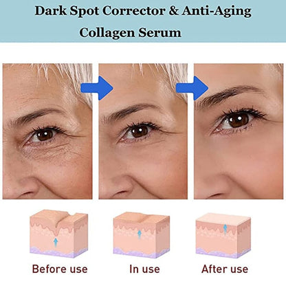 Creme Clareador Anti Olheiras Bolsas Para Os Olhos