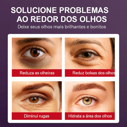 Creme em Bastão Para Os Olhos Com Retinol - Remove Bolsas, Melhora as Olheiras e Hidrata a Área dos Olhos | Kaype Store