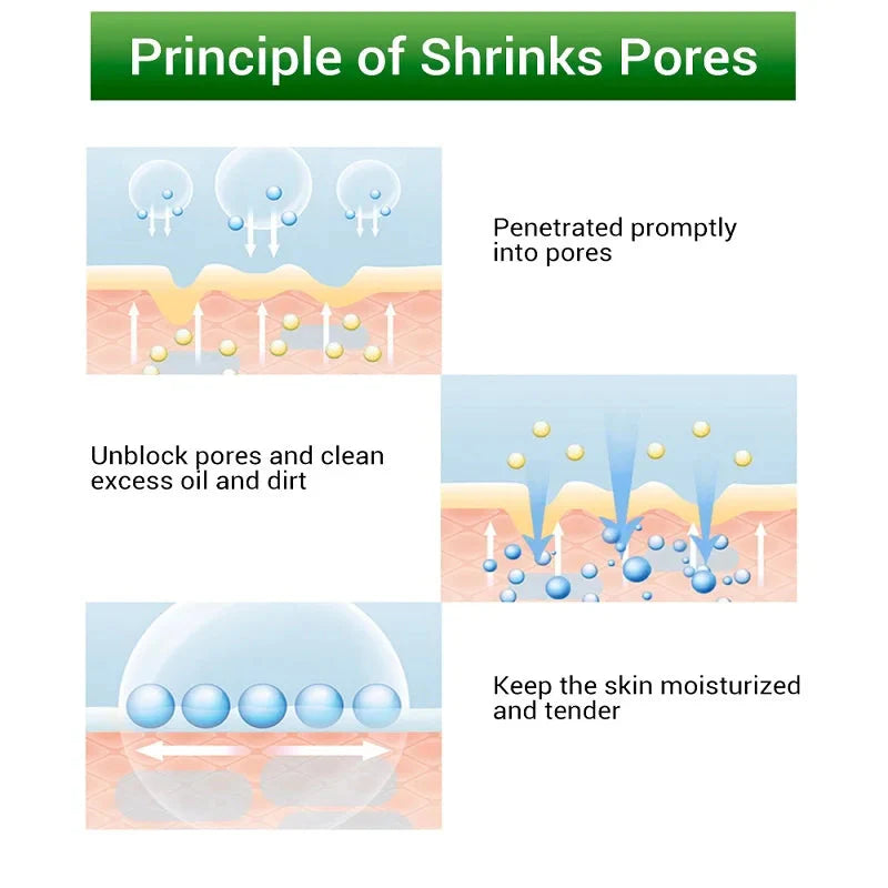 Creme Para Remoção De Poros E Clareamento de Manchas - PoroClean