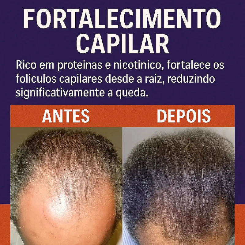 Feno Grego Original – Fortalecimento Capilar e Crescimento Saudável | Kaype Store