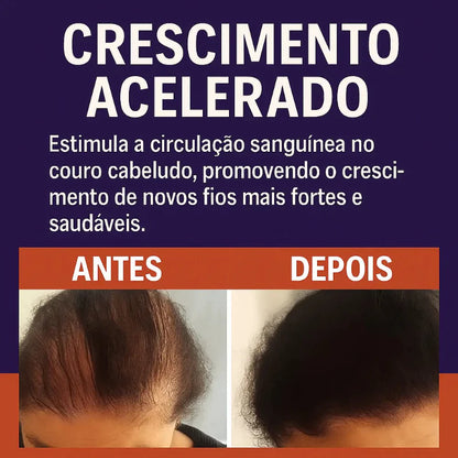Feno Grego Original – Fortalecimento Capilar e Crescimento Saudável | Kaype Store