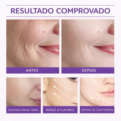 Fita Adesiva para Lifting Facial Invisível | Efeito Instantâneo – Kaype Store