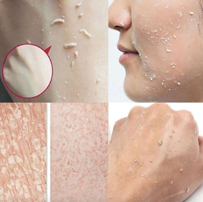 Gel Para Esfoliação e Clareamento Natural da Virilha, Axila e Rosto Com Extrato de Mamão Papaya - Skinetic