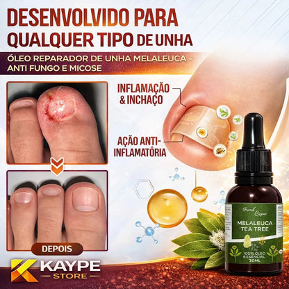 Óleo Reparador de Unha Melaleuca - Anti Fungo e Micose | 30ml
