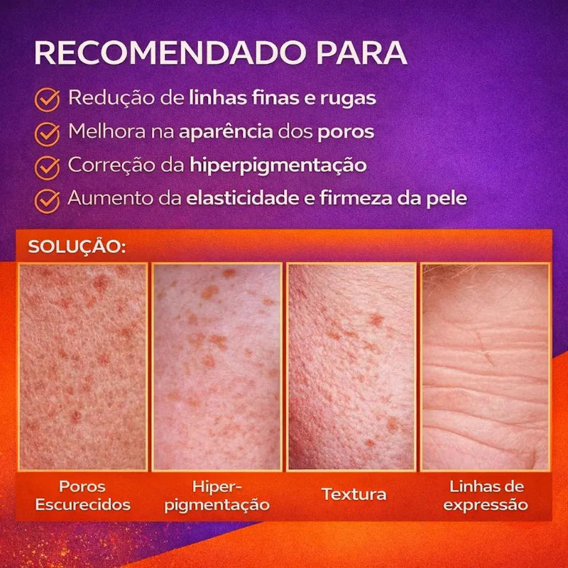 Retinol Shot – Sérum Coreano Anti-Idade | Kaype Store