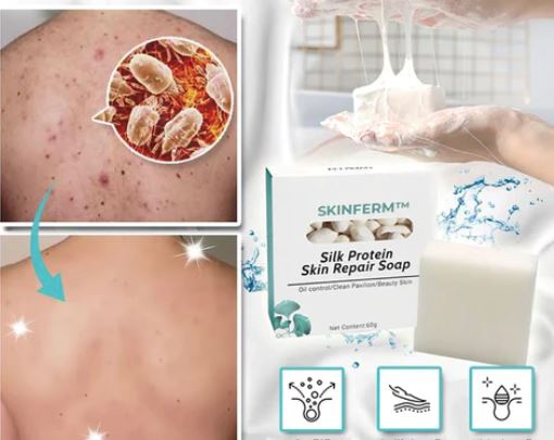 Sabonete Whitening Natural Com Leite e Enzimas Clareadoras da Pele da Virilha, Axila e Rosto