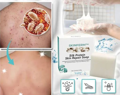 Sabonete Whitening Natural Com Leite e Enzimas Clareadoras da Pele da Virilha, Axila e Rosto