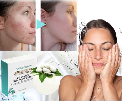 Sabonete Whitening Natural Com Leite e Enzimas Clareadoras da Pele da Virilha, Axila e Rosto
