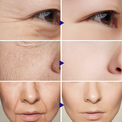 Sérum Retinol Anti-Rugas Combate Linhas De Expressão, olheiras, Flacidez e Viço