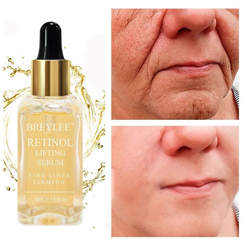Sérum Retinol Anti-Rugas Combate Linhas De Expressão, olheiras, Flacidez e Viço