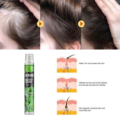 Spray para Crescimento Capilar | Combate à Queda e Fortalecimento - KaypeStore