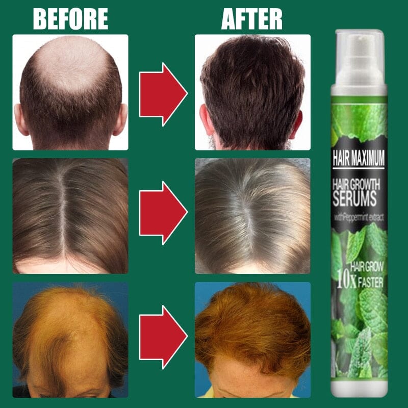 Spray para Crescimento Capilar | Combate à Queda e Fortalecimento - KaypeStore