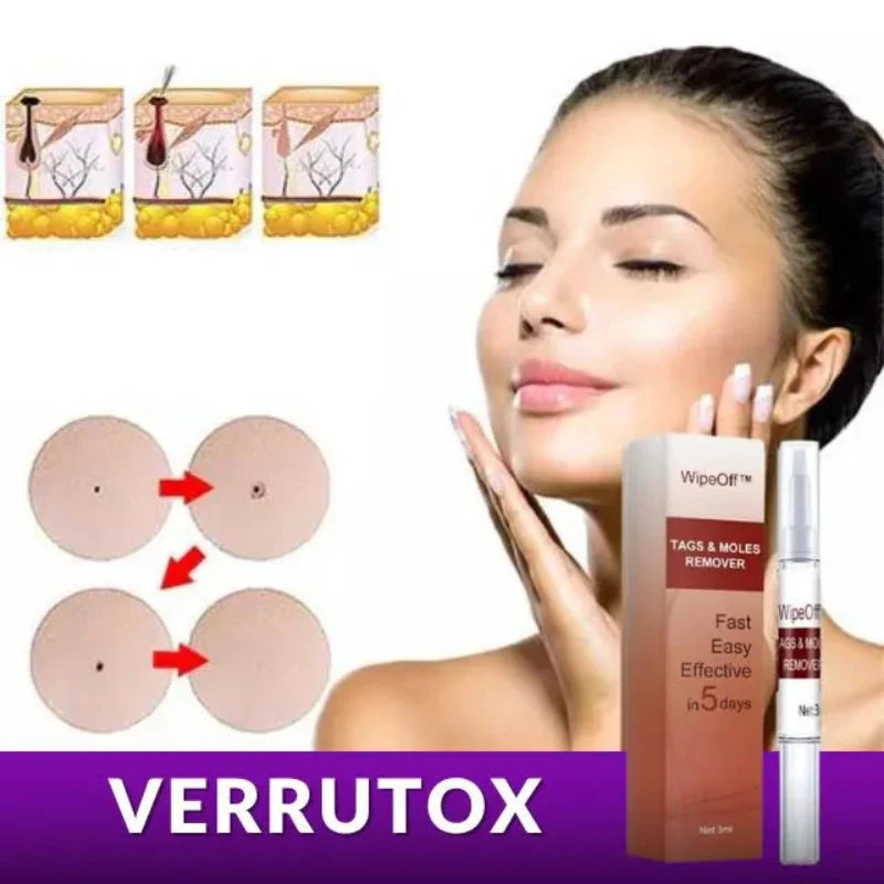 Verrutox Wipe Off - Removedor de Verrugas, Marcas e Manchas | Resultados Rápidos e Seguros | Kaype Store